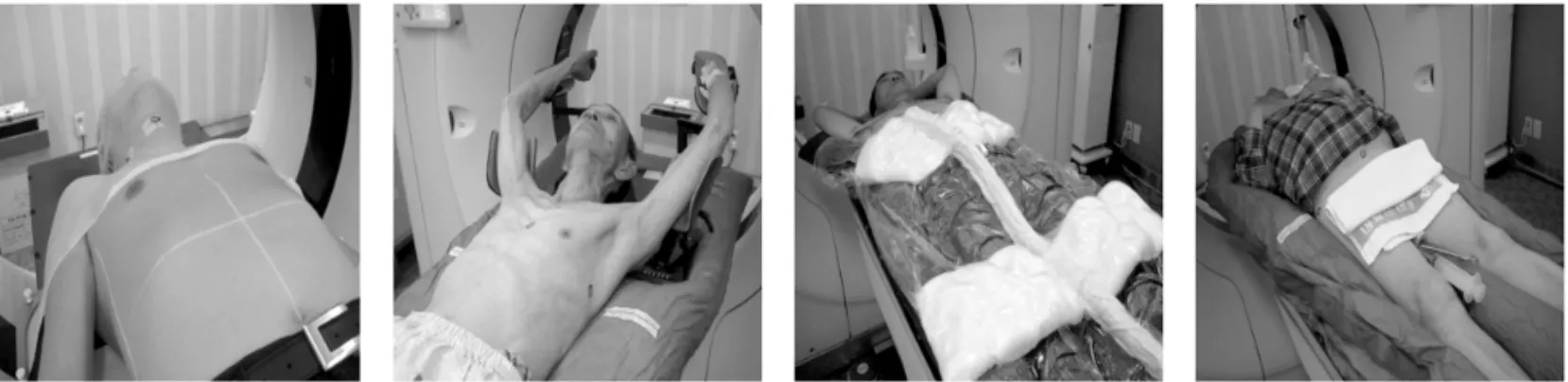 Fig 1. Demonstration of the treatment position from the patient immobilized in region respectively.