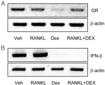 Fig. 4 − Effects of dexamethasone on the mRNA expression of GR and IFN- β . BMM cells were cultured for 48 hrs and the mRNA expression of GR (A) or IFN- β  (B) was determined by RT-PCR assay