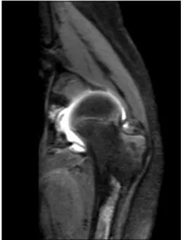 Fig. 2. 2019.08.07. Hip-joint x-ray
