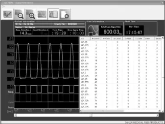 Fig. 2. ANZAI 4D system's AZ-733V program. Respiratory signal  and gated signal which were acquired in ANZAI 4D system.