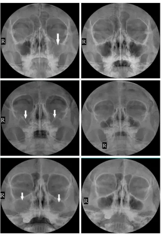 Fig. 1. PNS water's view