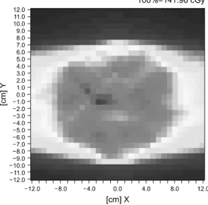 Fig. 9. Difference of dose evaluation plane (case 3) to reference  dose evaluation plane (case 3 - fourth normal dose delivery), (X,  Y: matrix size 24×24 cm 2 ).