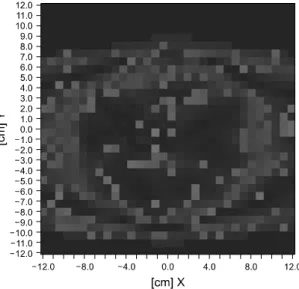 Fig. 14. Difference of gamma (γ) (case 2) to reference gamma  (γ) (case 2 - third normal dose delivery), (X, Y: matrix size  24×24 cm 2 ).
