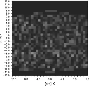 Fig. 17. Difference of gamma (γ) (case 5) to reference gamma  (γ) (case 5 - dose interruption in the LAO direction), (X, Y: 