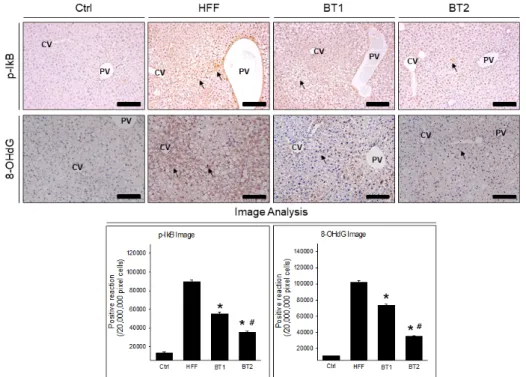 Fig. 3. The decrease of hepatic stress and anti-inflammation in hepatic tissue of mice with NAFLD by  Bangpungtongsungsan  (p-IκB and 8-OHdG immunohistochemistry) 