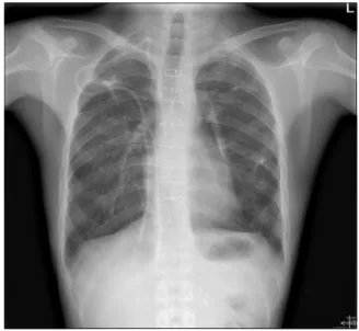 Fig. 2. 2018.04.12 Chest CT