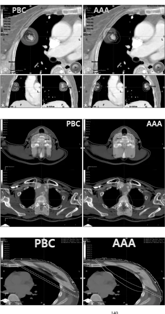 Fig. 5. 2-dimensional treatment plan- plan-ning about cervical spine using PBC and AAA.