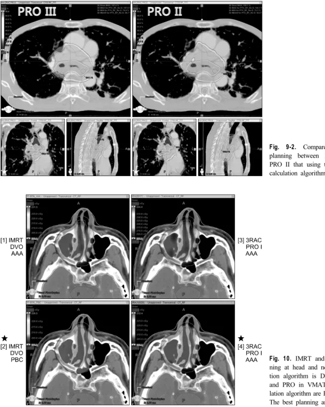 Fig. 9-2. Compared rapid arc  planning between PRO III and  PRO II that using the same dose  calculation algorithm (AAA).