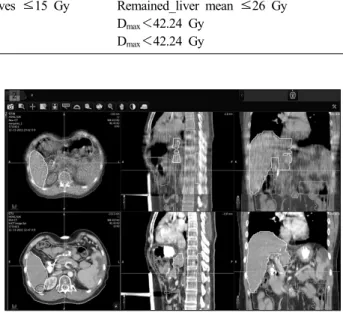 Fig. 3. Megavoltage computed tomography (MVCT) verification  through adaptive planning station.