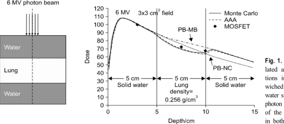 Fig. 1. Comparisons between calcu- calcu-lated and measured dose  distribu-tions in a 5 cm lung slab  sand-wiched between two 5 cm solid  water slabs for small incident 6 MV photon beams, respectively