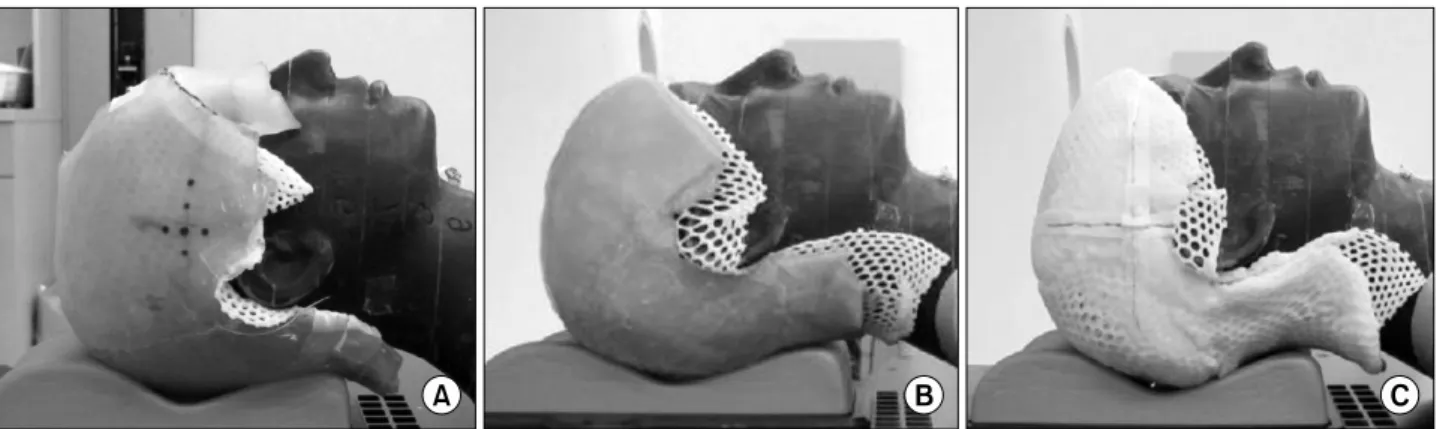 Fig. 1. CT-scan image to the 3 kinds of tissue equivalent. Bolx-II (A), paraffin wax (B), thermoplastic materials (C).