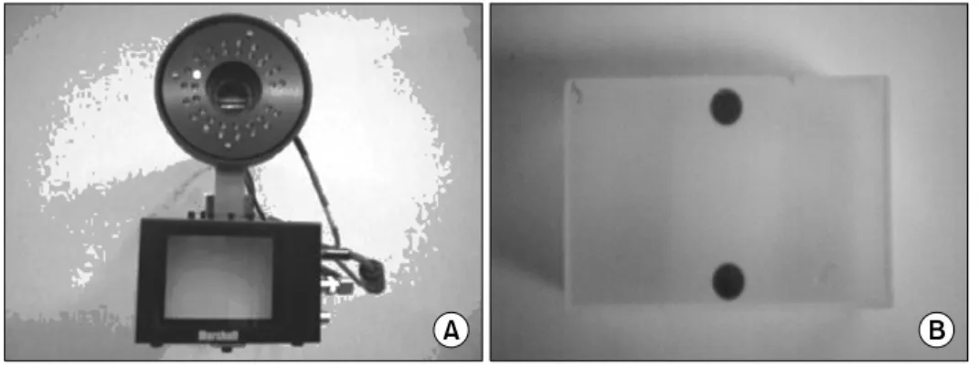 Fig. 2. Respiration observation sys- sys-tem. CCD camera and IR  illumi-nator (A), Surrogating marker  block (B).