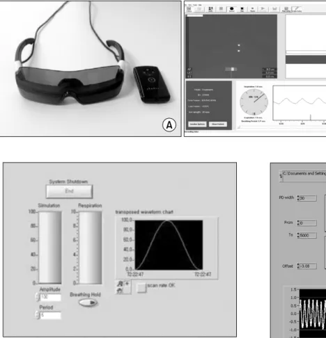 Fig. 3. Respiration acquisition sys- sys-tem. Head-mounted display goggle  (A), RPM respiratory gating  sys-tem 1.7 software (B).