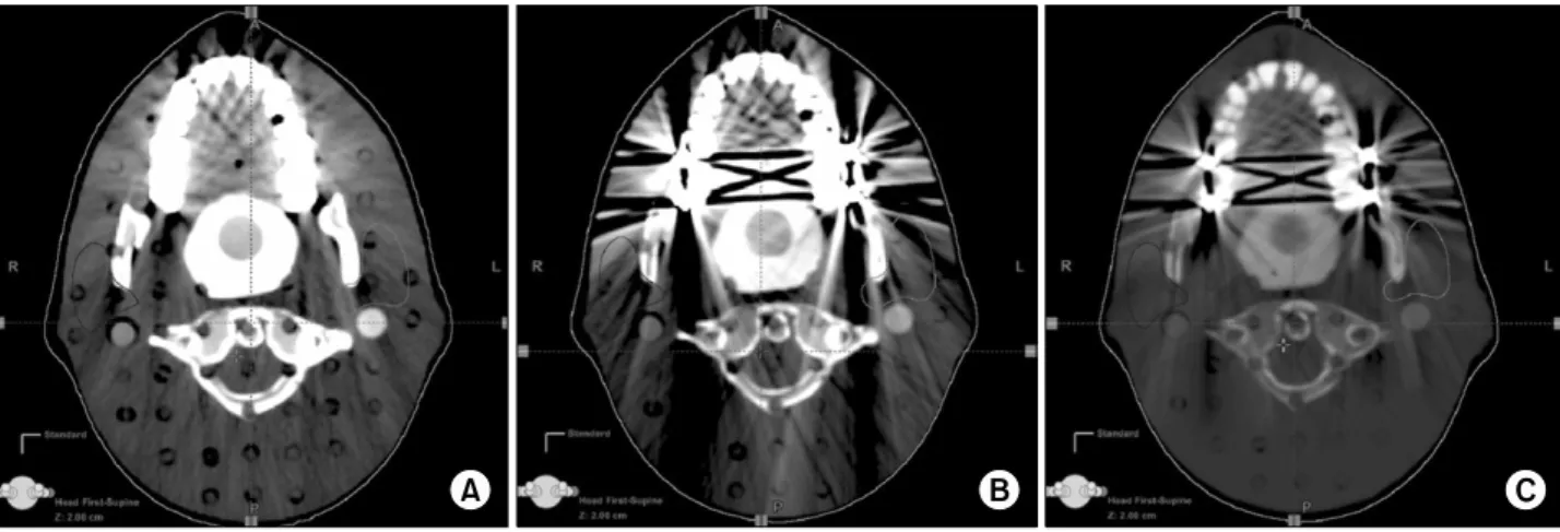 Fig. 10. Patient's image with metal artifact.