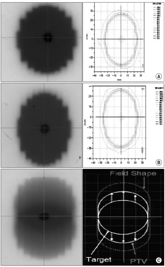 Fig. 9. Gafchromic films of the  three patterns. (A) Static pattern,  (B) Gating pattern, (C) Moving  pattern.