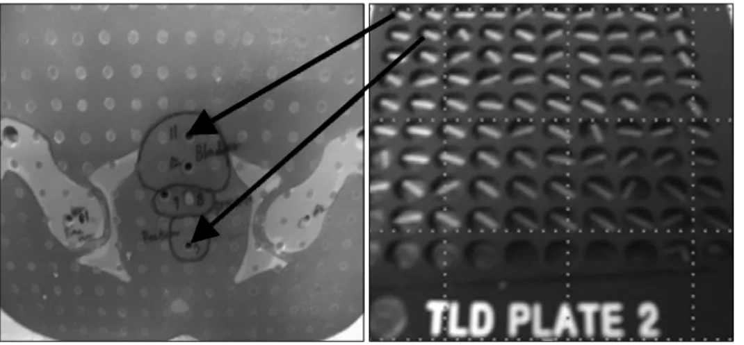 Fig. 5. Phantom contouring ima- ima-ge and TLD placement.