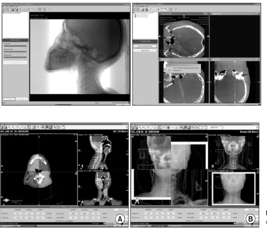 Fig. 3. (A) 3D/3D match. (B) 2D  match.