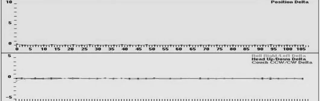 Fig. 1. Position delta result of  phantom in whole therapy x, y and  z directions within 0±0.2 mm, roll,  pitch and yaw direction 0±0.2 o .