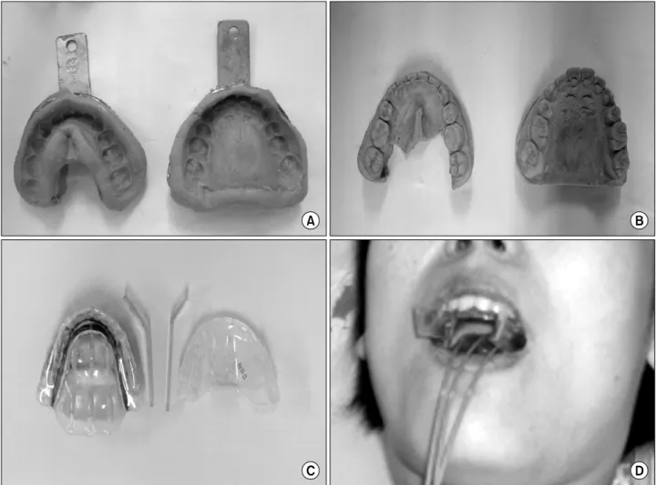 Fig. 3. Orthogonal image by conventional simulation with dummy source in Lumencath catheter
