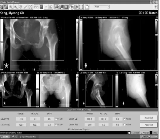 Fig. 15. The registration window  of the Varian On Board Imager  (Varian Medical Systems, Palo  Alto, CA), and the pelvis CT  DRR image matching window.