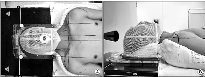 Fig. 4. Set up error for the patient group in the (A) Sagital plane: 