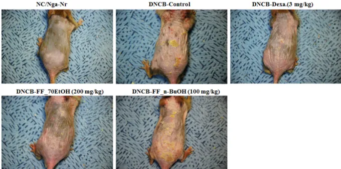 Fig. 10. WBC differential counts in atopic dermatitis NC/Nga mice induced by DNCB