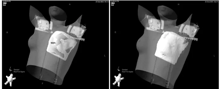 Fig. 9. 3D-model view wedge filter VS ISC.