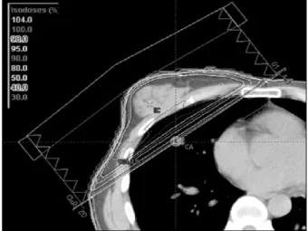 Fig. 16. 10 MV X-ray with W15.