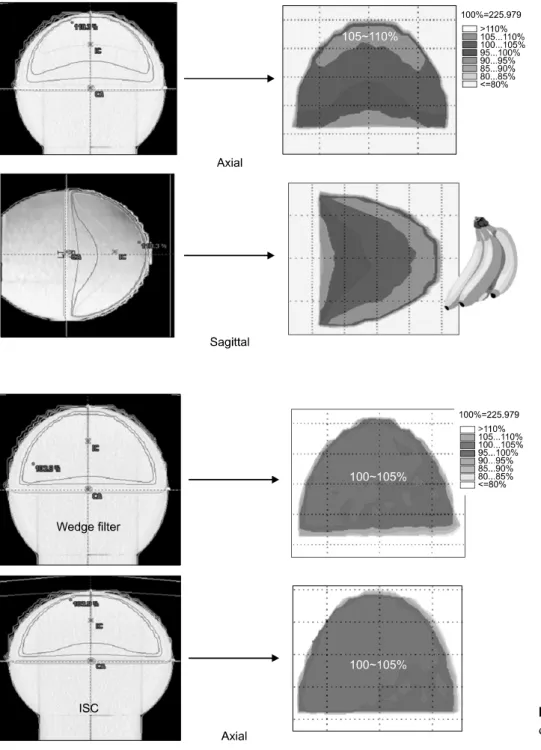 Fig. 23. Wedge filter &amp; ISC plan  dosimetry (axial plane).