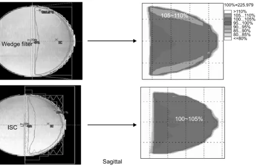 Fig. 24. Wedge filter &amp; ISC plan  dosimetry (sagittal plane).