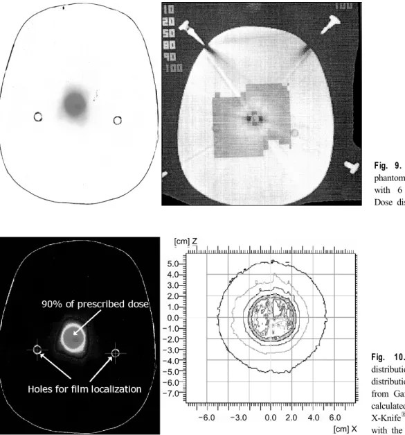 Fig. 9. Films in the humanoid  phantom were exposed to 3 Gy  with 6 MV photon arc beam