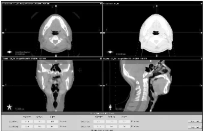 Fig. 2. Photograph of the Clinac ix with CBCT and OBI system.