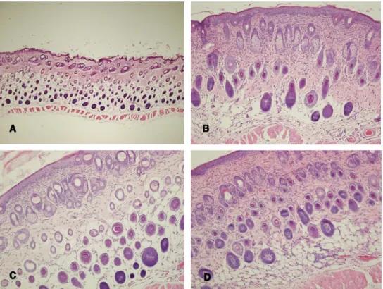Fig. 6. Histologic examination of skin lesion in DNCB-induced dermatitis model of mice