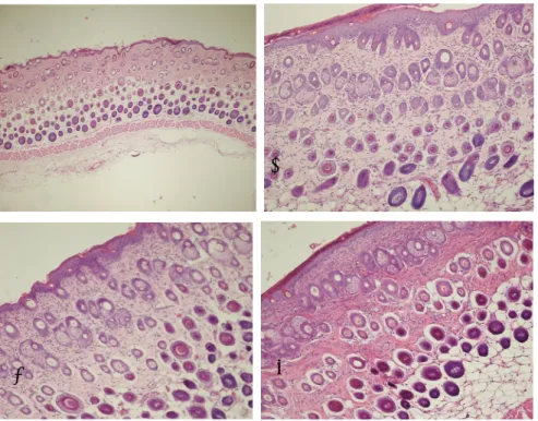 Fig. 12. Effects of AI on histopathological observation of dorsum skin in AD induced mice