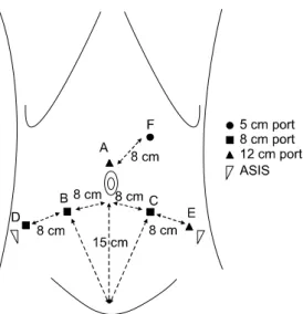 Fig.  2.  Trocar  placement  for  a  small  pelvis.  The  letters  represent  the  sequence  of  trocar  placement