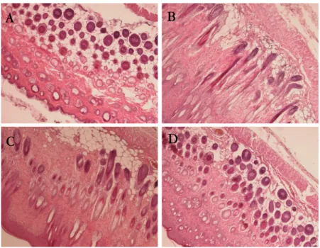 Fig. 8. Effects of CP on histopathological observation of dorsum skin in ACD mice