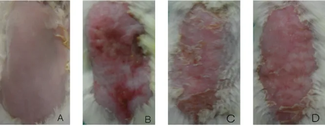 Fig. 3. Effects of RS on clinical aspect in ACD mice
