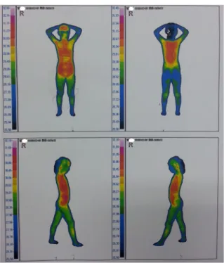 Fig 3. 2013. 9. 17 DITI result 회향을 4 g으로 늘려 처방하였다. (6)  2013년  9월  12일  ~  2013년  9월  16일 9월 16일,  추석연휴가 겹쳐 1주일분 탕약을 미리 가 져갔다