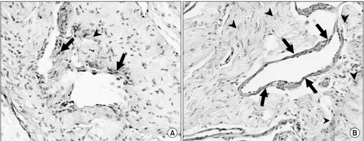 Fig.  3.  Immunohistochemical  staining  of  annexin  A4  in  cavernous  sections  obtained  from  the  penile  tissue  2  weeks  after  sham  or  cavernous  nerve  resection  (CNR)  operation  ((A)  sham  x200,  (B)  CNR  x200,  arrow:  endothelial  cells