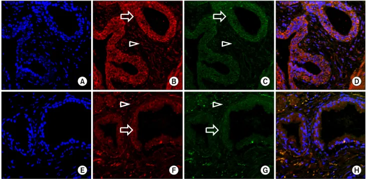 Fig.  3.  Immunofluorescent  staining  of  VEGF  and  5AR  in  the  finasteride-treated  and  control  groups