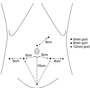 Fig. 1. Port  placement  for  robot-assisted  laparoscopic  radical  prostatectomy (six-port  technique).