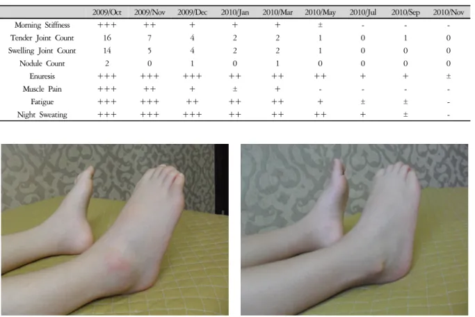 Figure 2. Right ankle (September. 30. 2010)