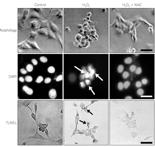 Fig.  2.  The  effect  of  N-acetylcysteine  (NAC)  on  H 2 O 2 -induced  morphological  change