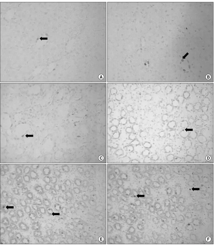 Fig.  2.  The  terminal  deoxynucleotidyl  transferase (TdT)-mediated  deoxyuridine  triphosphate (dUTP)  in  situ  nick-end  labeling (TUNEL)  study  in  the  rabbits'  kidneys