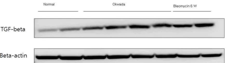Fig  2.  Western  blot  analysis.  Effect  of  Okwada  on  TGF-beta  protein  expression  in  lung  tissues  of  normal,  treatment  of  Okwada,  six  weeks  after  bleomycin  instillation.