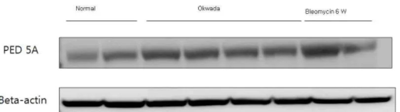 Fig  4.  Western  blot  analysis.  Effect  of  Okwada  on  interleukin  4  protein  expression  in  lung  tissues  of  normal,  treatment  of  Okwada,  six  weeks  after  bleomycin  instillation.