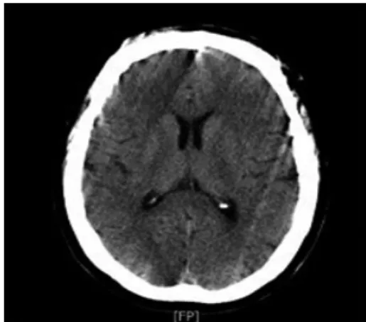 Fig. 1.  Br-CT(non contrast, 2020.12.29.) 