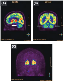 Fig. 1.   Brain PET-CT imaging of pateint