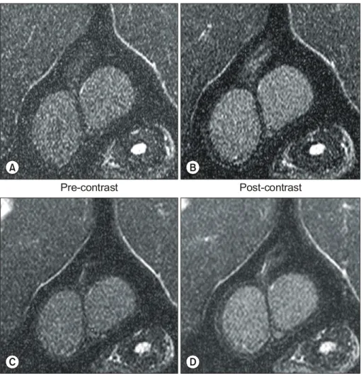 Fig.  2.  T1-weighted  MR  images  of  the  testis  at  30  minutes (A  and  B)  and  2  hours (C  and  D) (TR/TE=320/20)  in  the  control  group
