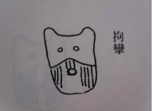 Fig.  1.  ≪腹診考≫ 18) 에서 拘攣의 腹診圖 條文 을 살펴보았다. ≪類聚方≫ 條文의 小柴 胡湯  條 에서는 腹痛과 관련하여 腹中痛, 腹中 急痛 , 腹痛而嘔의 언급이 있었고, 桂枝湯 條에 서는 身疼痛者, 身體疼痛者, 身痛不休者의 표 현이 있었다
